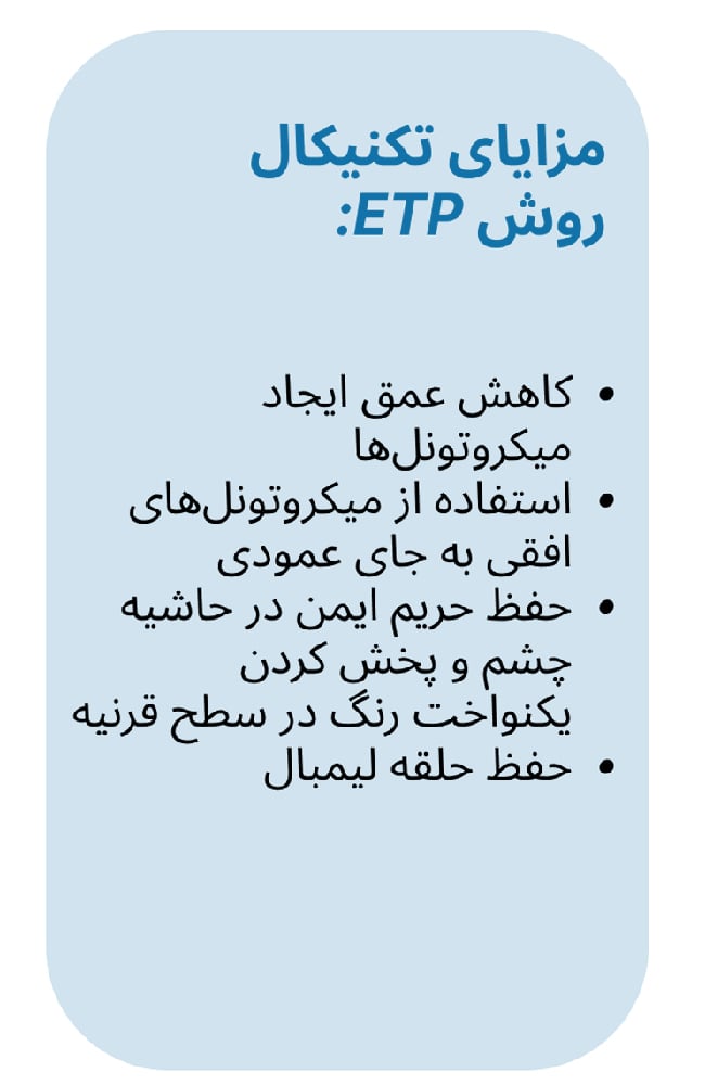 مزایای روش ETP