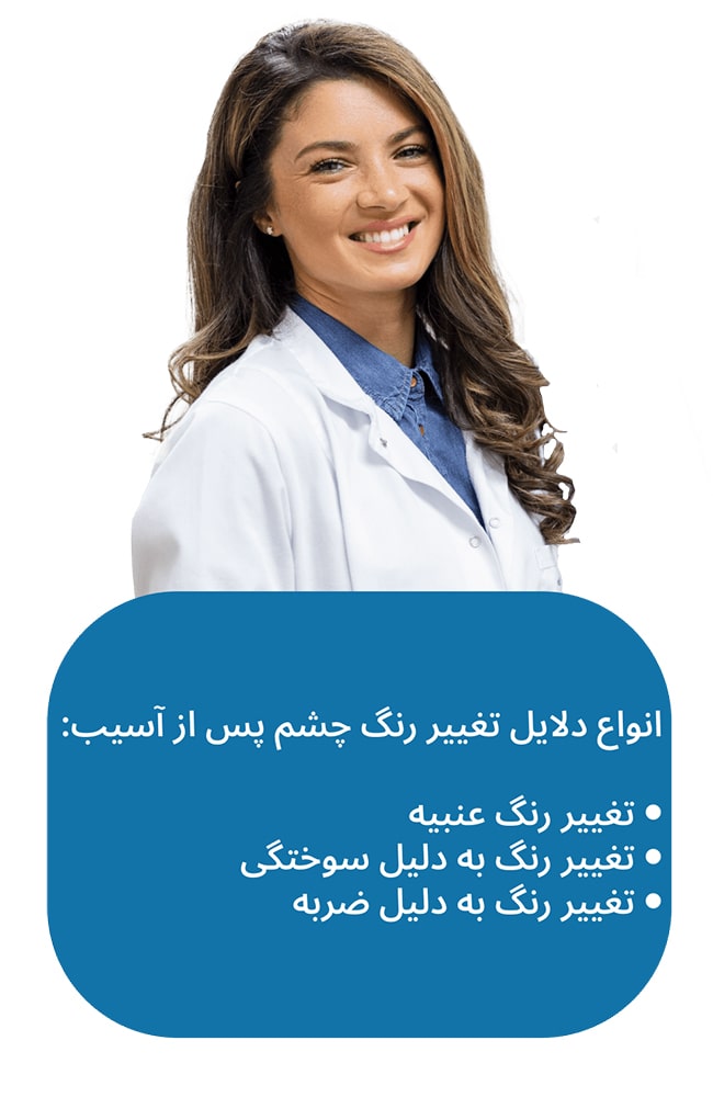 انواع دلایل تغییر رنگ چشم پس از آسیب