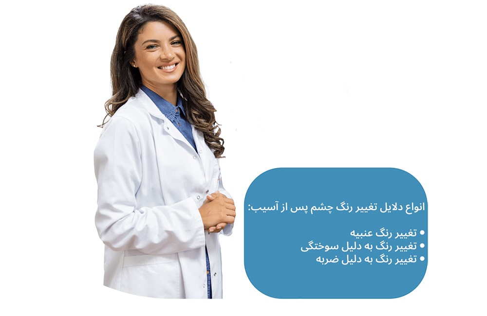 انواع دلایل تغییر رنگ چشم پس از آسیب