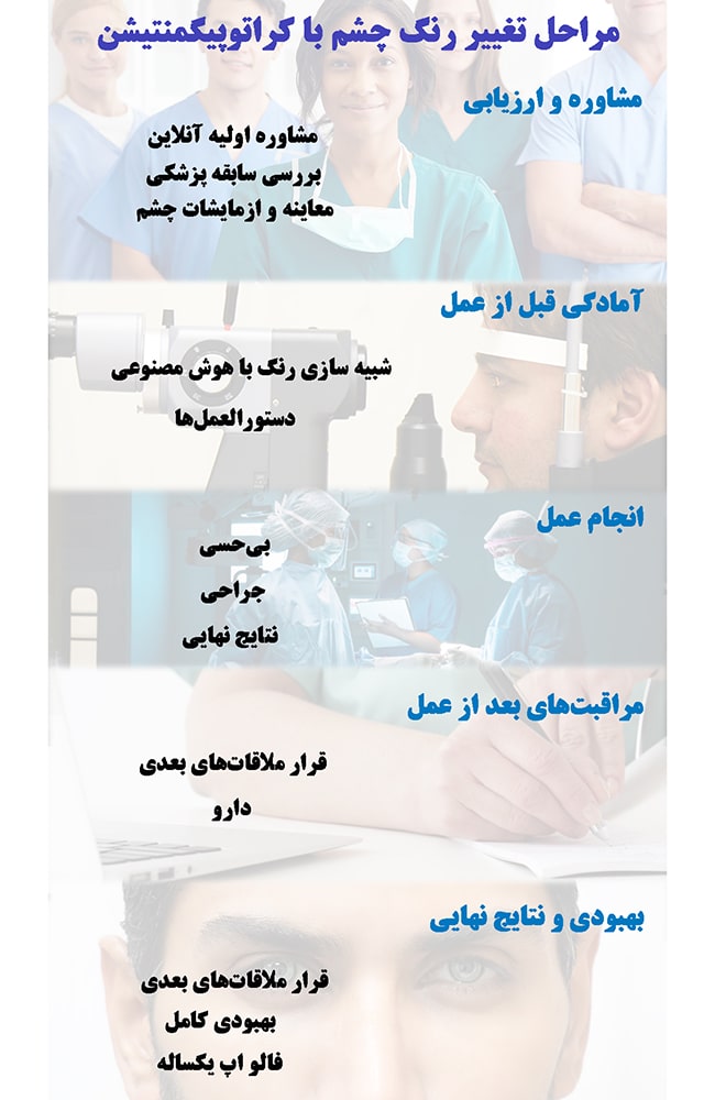 مراحل تغییر رنگ چشم با روش کراتوپیگمنتیشن