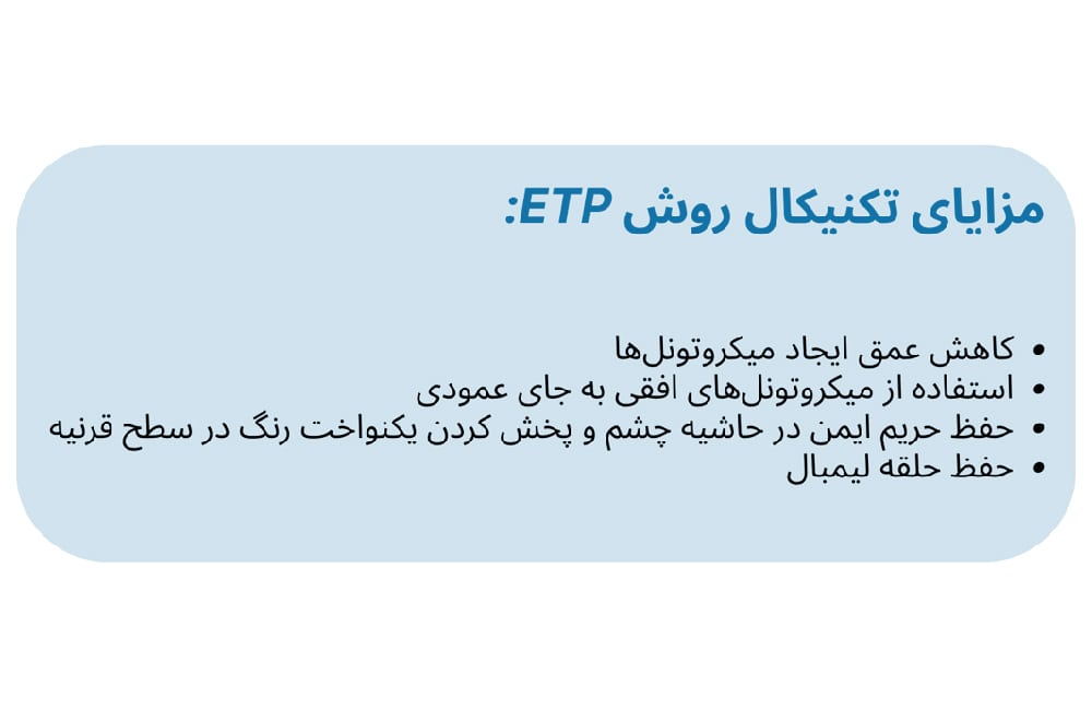 مزایای روش ETP