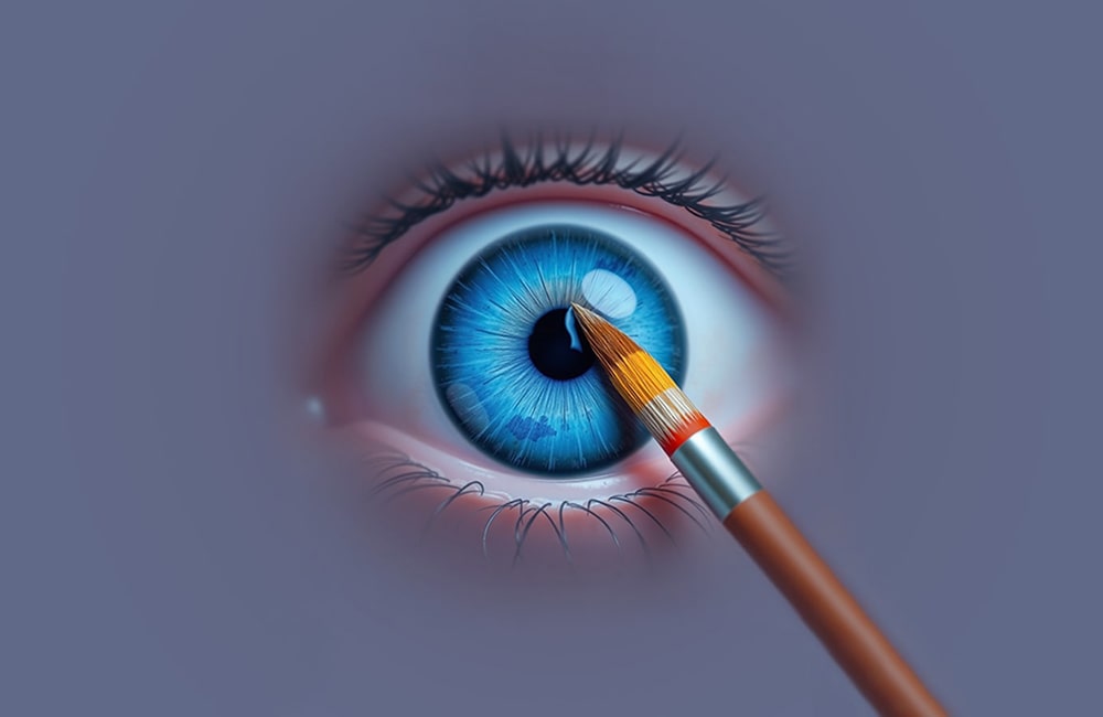 کراتوپیگمنتیشن