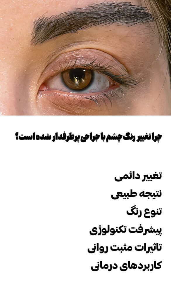 چرا تغییر رنگ چشم با جراحی پرطرفدار شده است؟