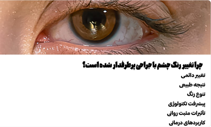 چرا تغییر رنگ چشم با جراحی پرطرفدار شده است؟