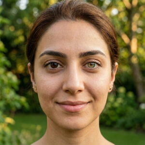 تغییر رنگ دائمی چشم از قهوه‌ای به سبز در بیمار ایرانی — نتیجه واقعی کراتوپیگمنتیشن در کلینیک رویال آی کالر