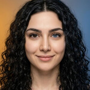 تغییر رنگ دائمی چشم از قهوه‌ای تیره به آبی روشن — نتیجه واقعی کراتوپیگمنتیشن و لیزر ویزومکس در کلینیک رویال آی کالر