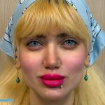 نتیجه نهایی، درخشان و طبیعی پس از عمل تغییر رنگ چشم دائمی به کد رنگی آبی (Blue 1). این تغییر خیره‌کننده با بالاترین سطح ایمنی، بدون درد و توسط پیشرفته‌ترین دستگاه لیزر ویزومکس در مجموعه رویال آی کالر به دست آمده است.