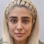 نتیجه تغییر رنگ چشم به سبز زمردی با کراتوپیگمانتیشن - Royal Eye Color