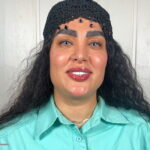 نتیجه تغییر رنگ چشم به خاکستری Magical Gray با کراتوپیگمنتیشن – کلینیک رویال