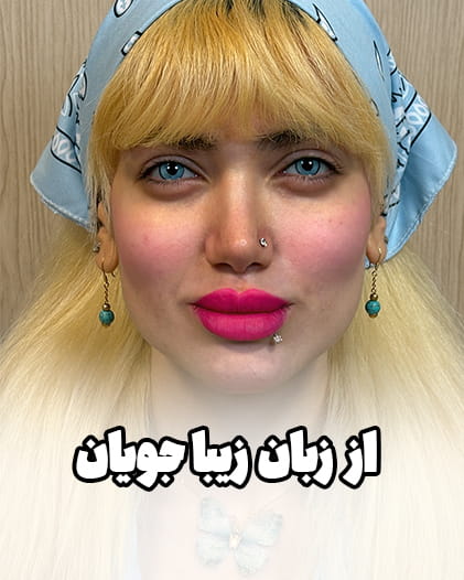 عملش چطوره؟ “تقریبا در حد یه قطره ریختن تو چشمه!”