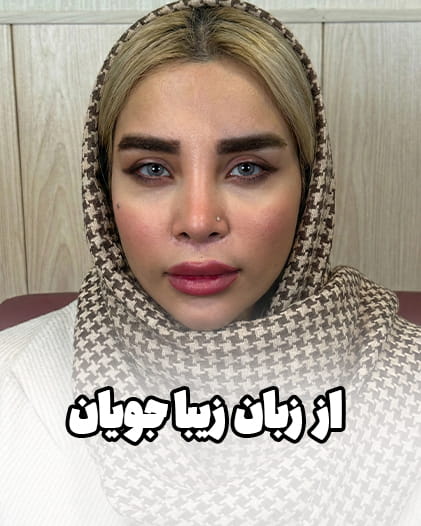 “یه تغییر اساسی می‌خواستم!” عمل خیلی سبک و راحت بود