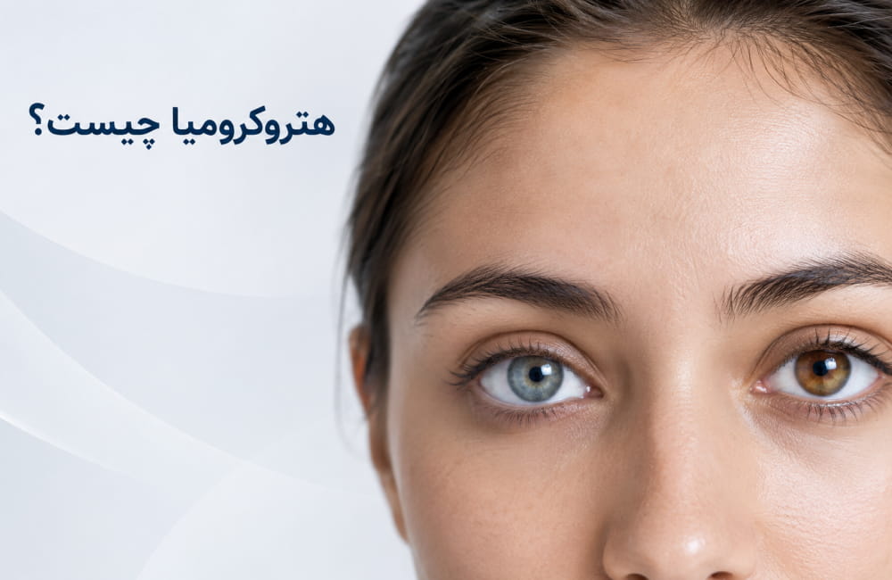هتروکرومیا چیست؟