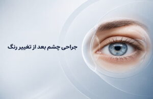 تصویر مفهومی جراحی چشم بعد از تغییر رنگ با نمای نزدیک چشم و لایه‌های شفاف پزشکی