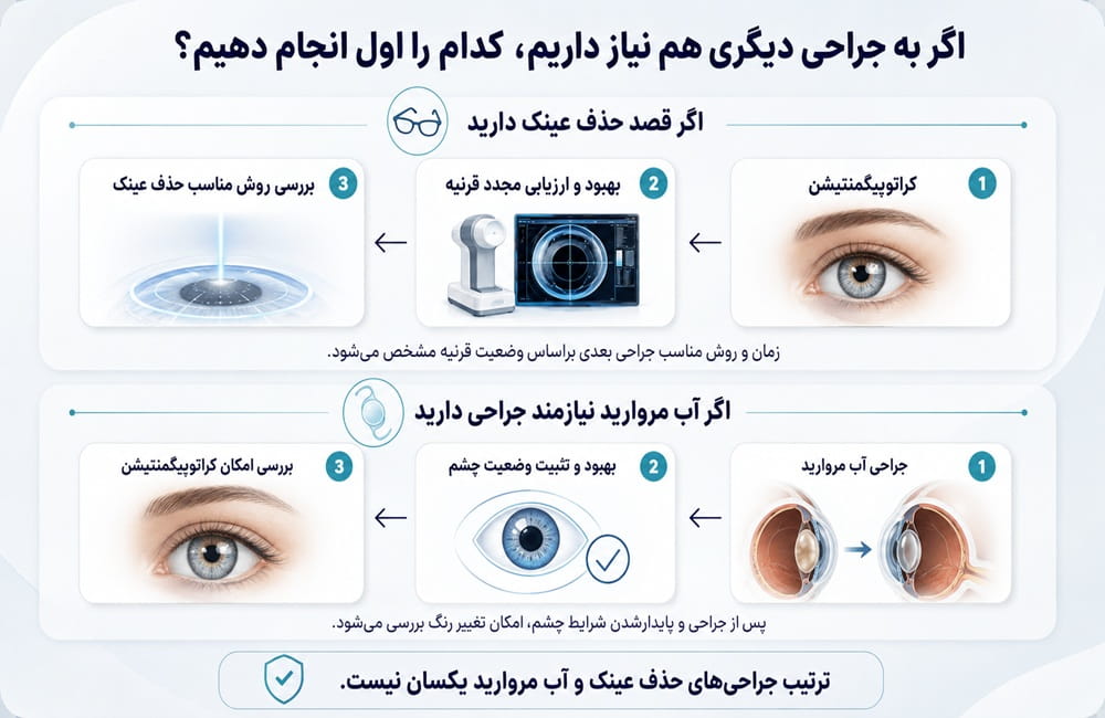 فلوچارت ترتیب کراتوپیگمنتیشن با جراحی حذف عینک و جراحی آب مروارید